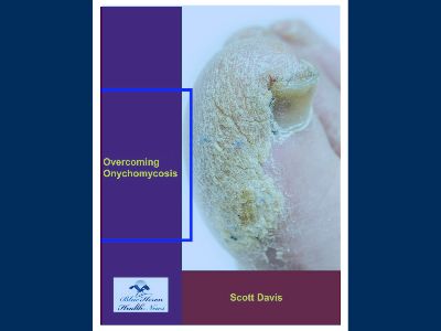 Overcoming Onychomycosis™ EBook PDF Download Free | Focusky