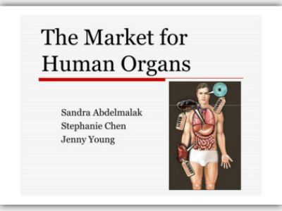market for human organs Kidney for sale by owner: human organs, transplantation, and the market washington: georgetown university press 2005 resolution on human organ and tissue. market for human organs Kidney for sale by owner: human organs, transplantation, and the market washington: georgetown university press 2005 resolution on human organ and tissue.
