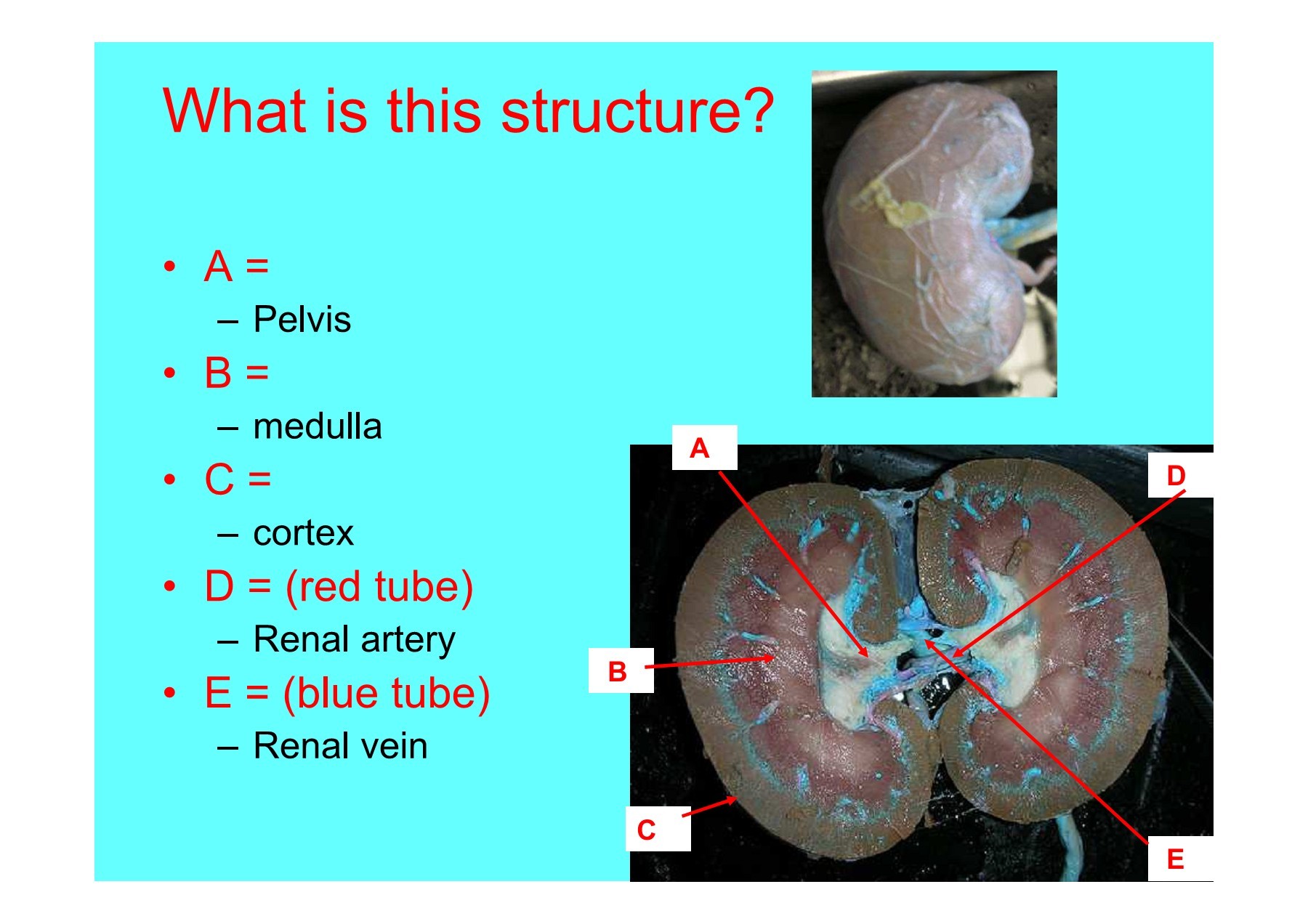 Fetal Pig Kidney Kidney Dissection