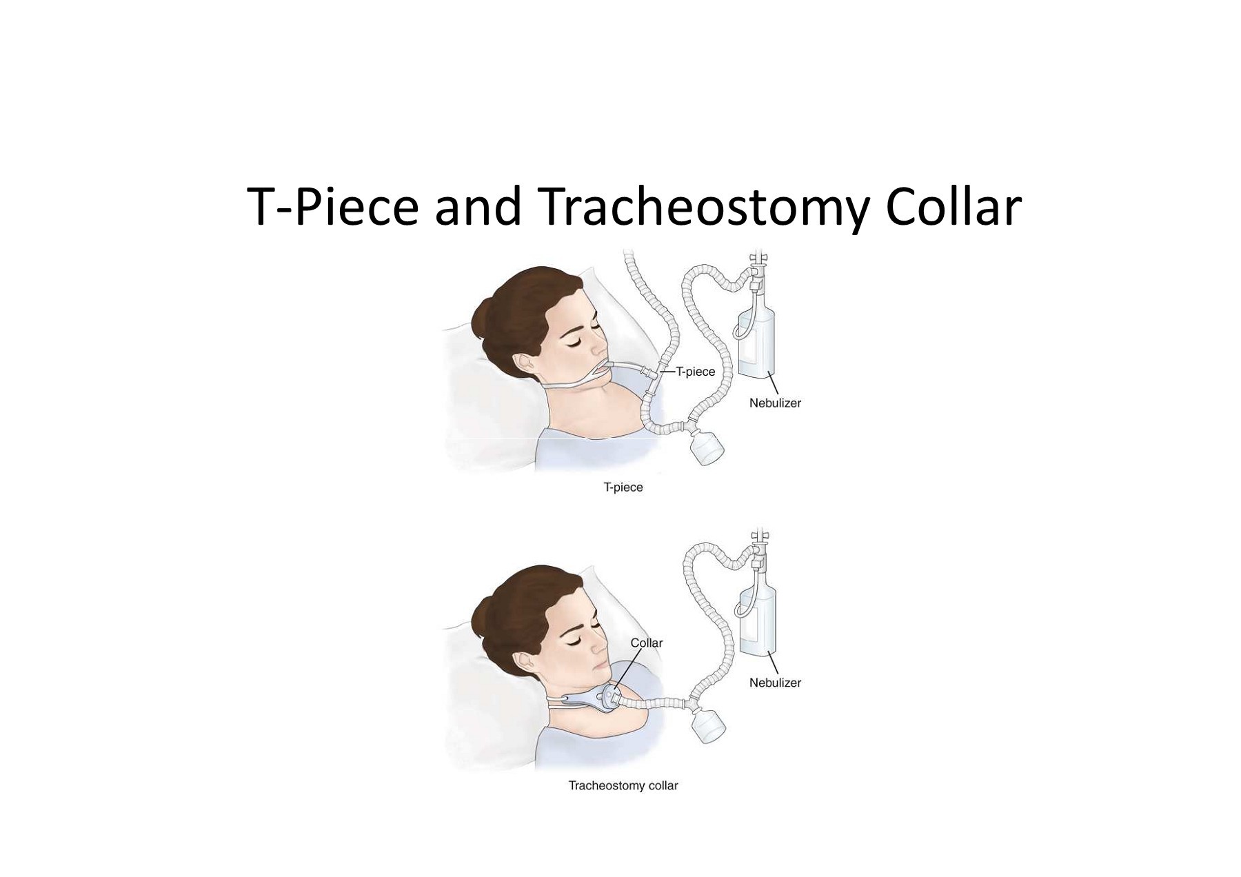Tracheostomy Collar And T Piece